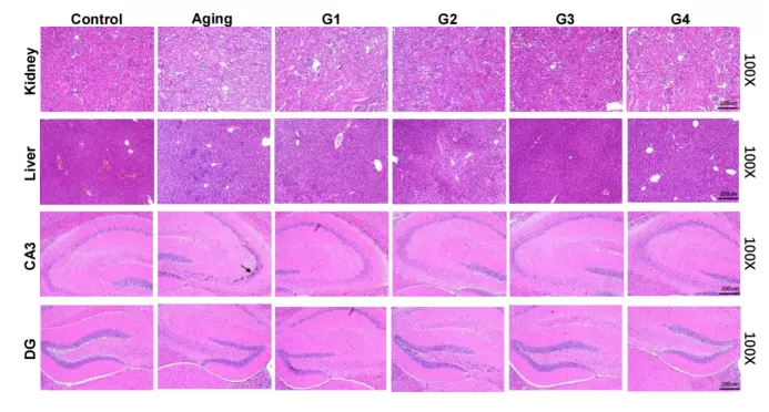 Résultats impérieux dans le modèle de vieillissement naturel Résultats impérieux dans le modèle de vieillissement naturel