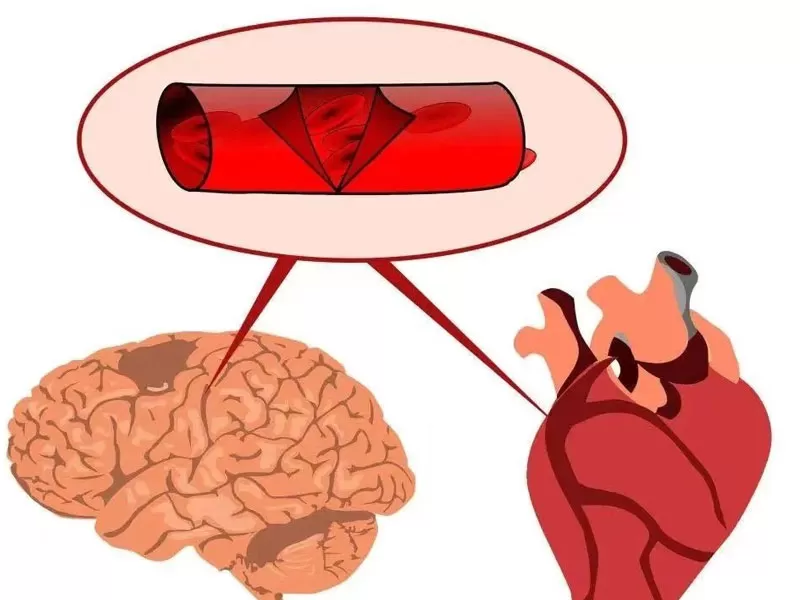 Série anti-âge: Resvératrol