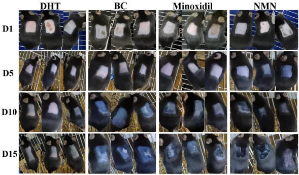 NMN et croissance des cheveux: nouvelles preuves de l'alopécie androgénétique (AGA)