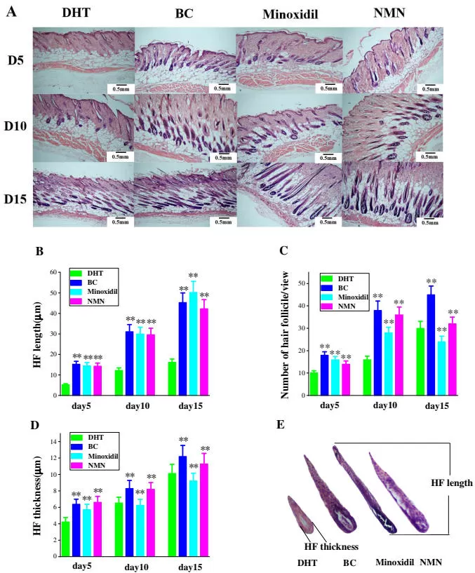 nmn-and-hair-growth-new-evidence-in-androgenetic-alopecia-aga-3.jpg nmn-and-hair-growth-new-evidence-in-androgenetic-alopecia-aga-3.jpg